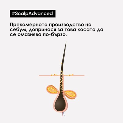 Anti-Oiliness - Шампоан, подходящ за скалп, склонен към омазняване - 1000 ml Anti-Oiliness - Шампоан, подходящ за скалп, склонен към омазняване - 1000 ml